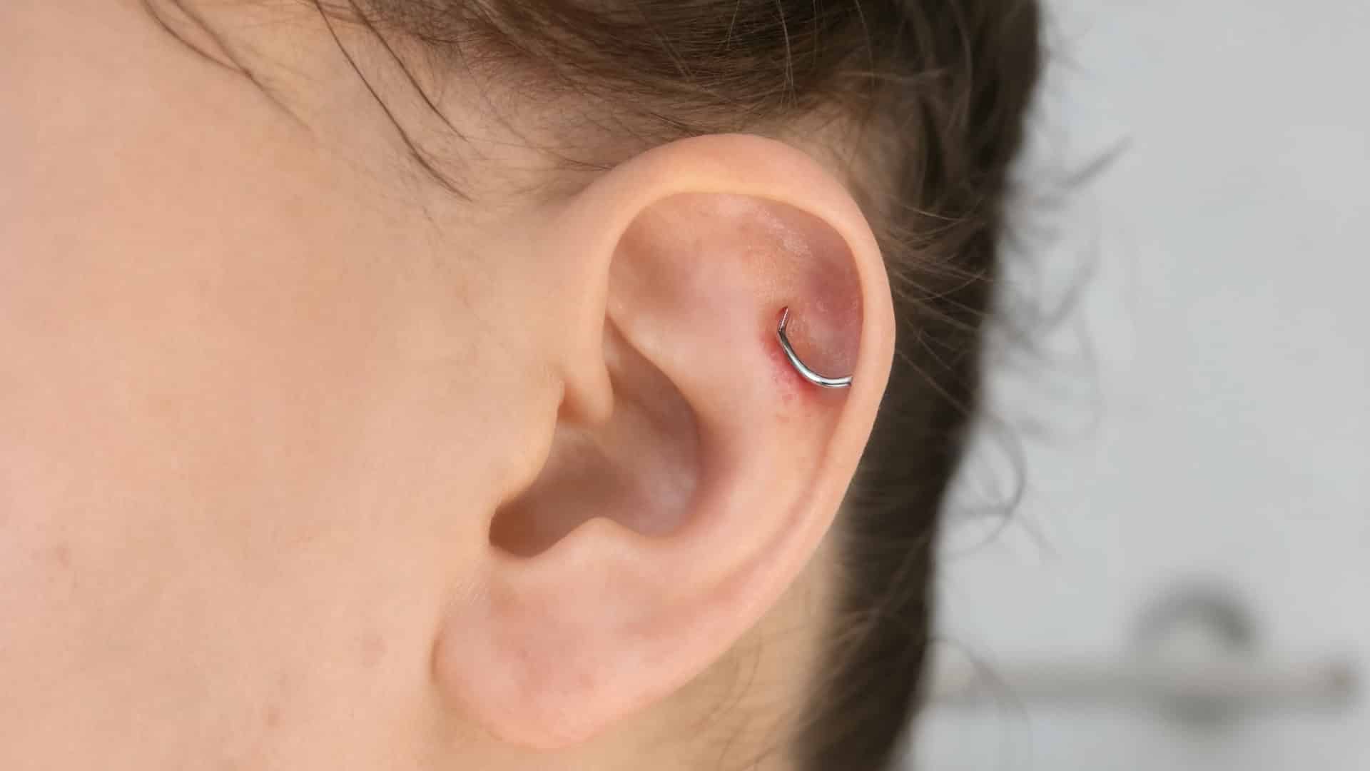 piercing bump showing mild irritation from healing stress, friction, or pressure on skin near piercing