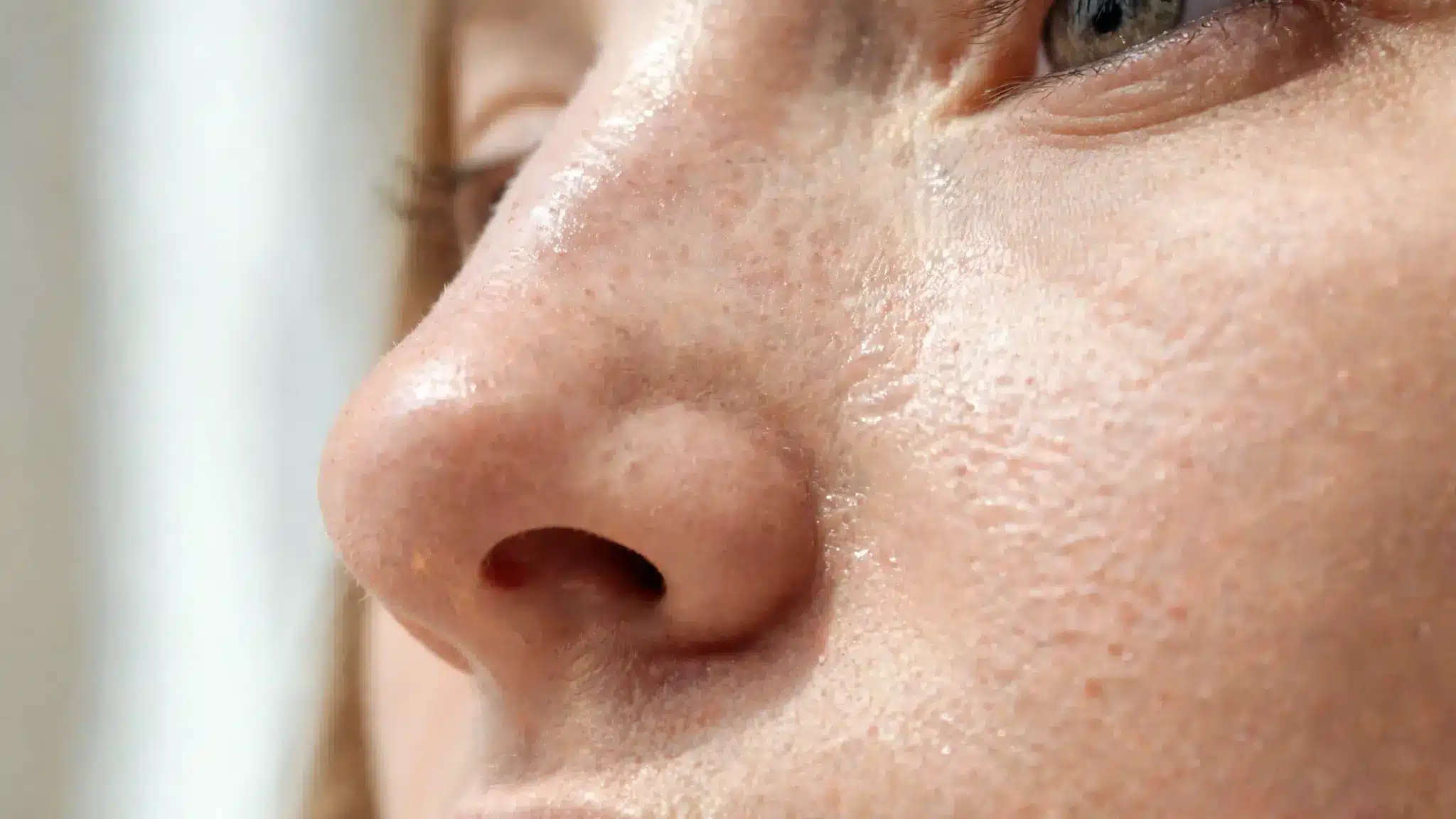 side close-up of a woman’s oily nose and cheek showing visible pores, shine, and natural skin texture