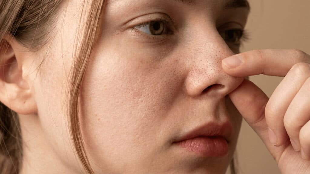 close up of woman examining nose pores and visible blackheads on skin surface