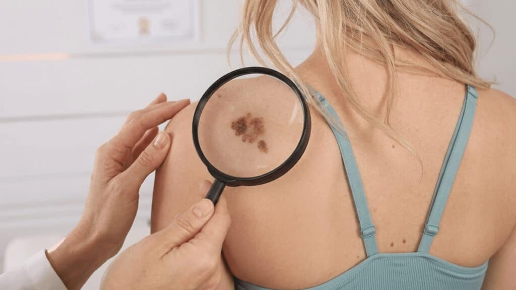 Realistic close-up of woman showing her beauty mark to the doctor wearing green top in open hairs