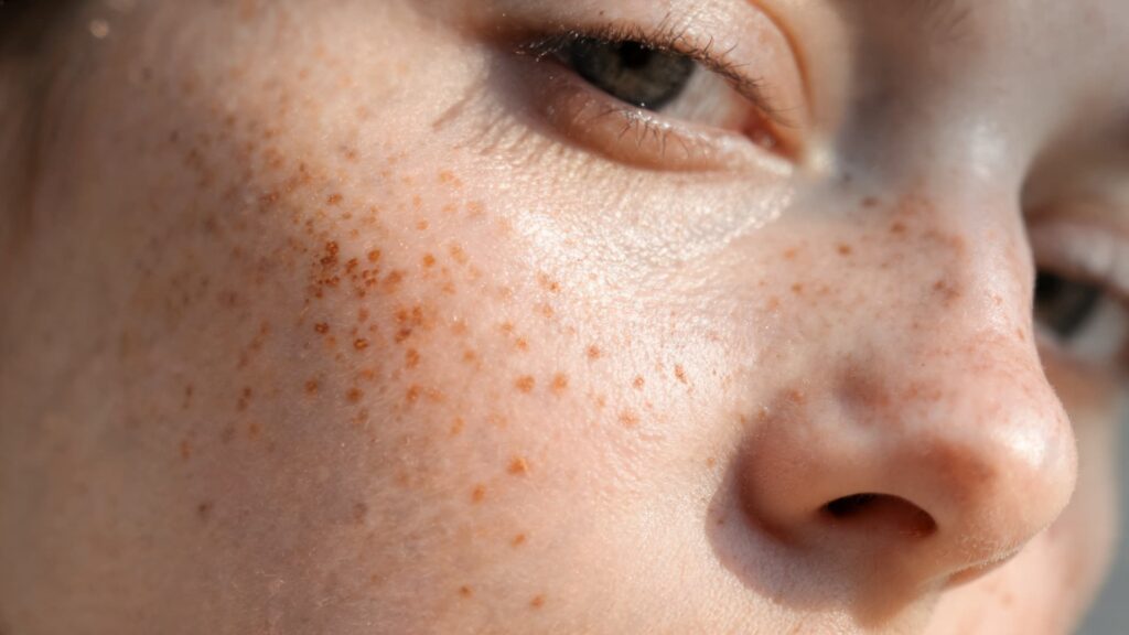 close up skin with natural freckles showing how sun exposure and skin tone create realistic texture