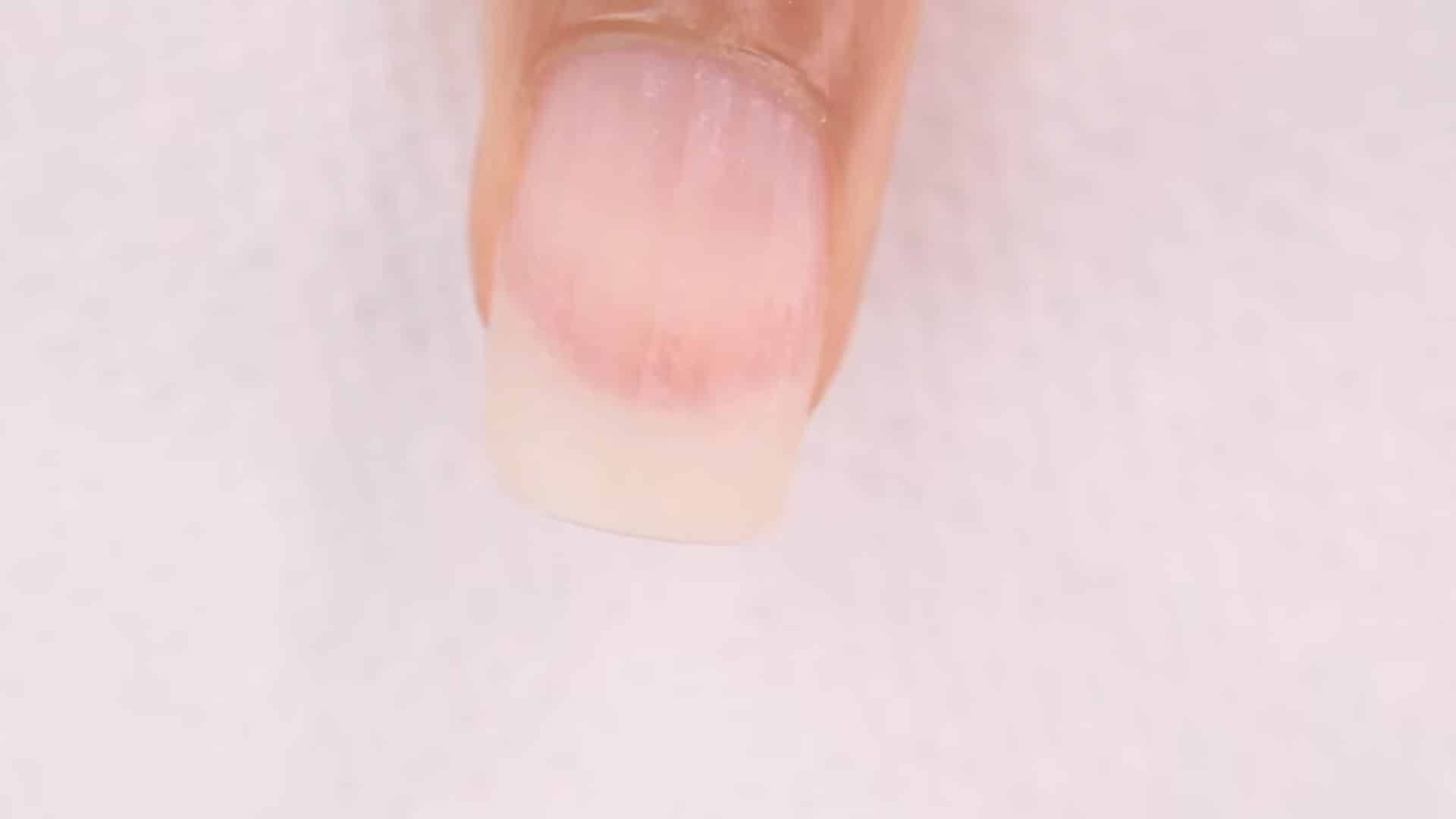 Remove Natural Shine