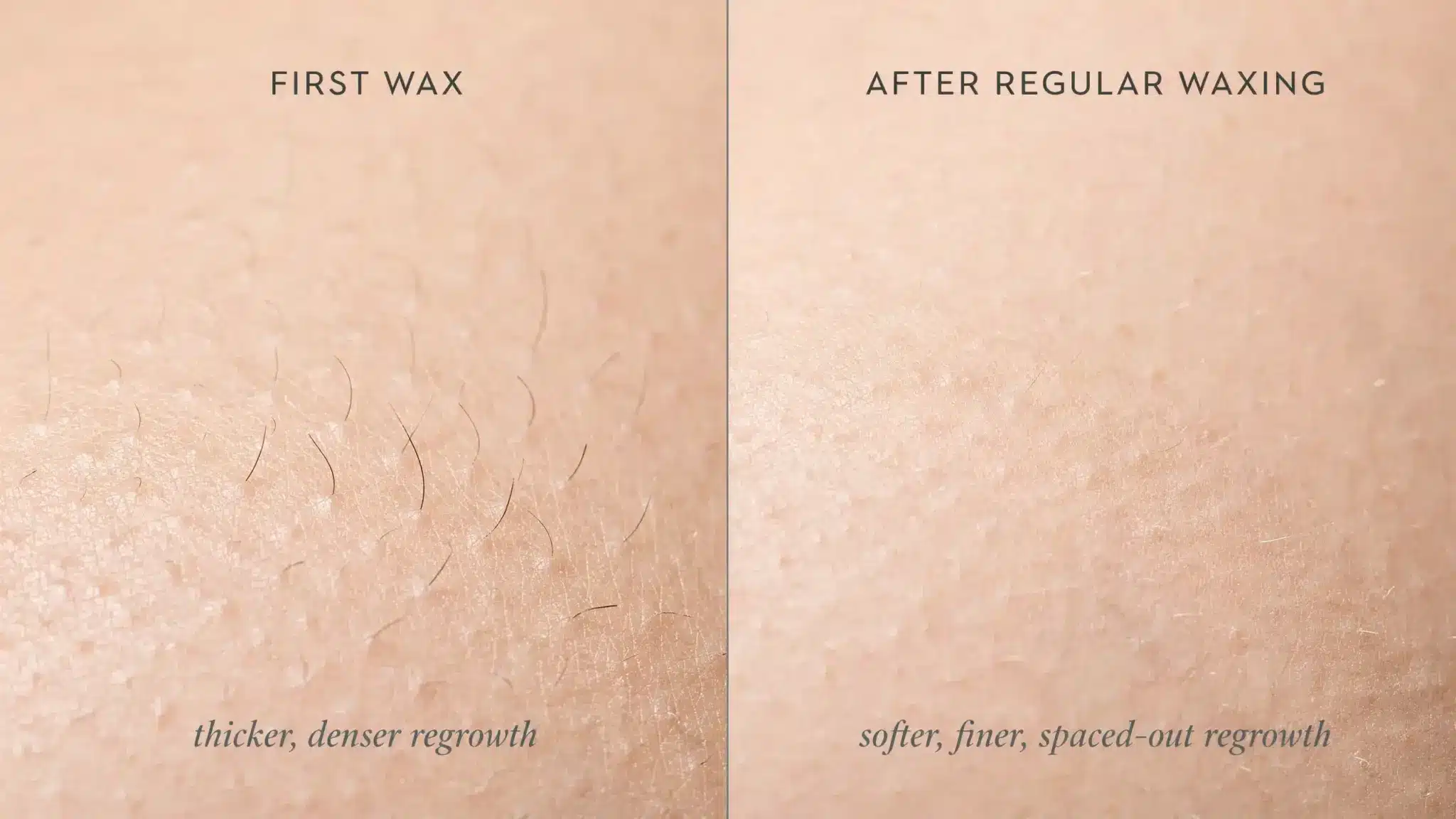 Comparison showing thicker regrowth after first wax and finer, sparser hair after repeated waxing sessions.